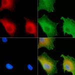 CATSPER4 Antibody in Immunocytochemistry (ICC/IF)