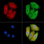 CRABP1 Antibody in Immunocytochemistry (ICC/IF)