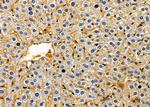 CRABP1 Antibody in Immunohistochemistry (Paraffin) (IHC (P))