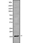 CRABP1 Antibody in Western Blot (WB)