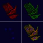 CCP110 Polyclonal Antibody