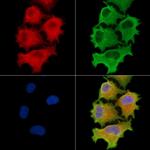 CEP41 Polyclonal Antibody