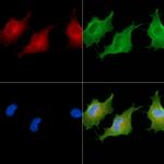 CSPP1 Polyclonal Antibody