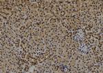 CDR1 Antibody in Immunohistochemistry (Paraffin) (IHC (P))