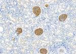 CDR1 Antibody in Immunohistochemistry (Paraffin) (IHC (P))