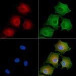 PDE3B Polyclonal Antibody