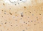 CKLF Antibody in Immunohistochemistry (Paraffin) (IHC (P))
