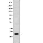 CKLF Antibody in Western Blot (WB)
