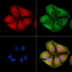 CLCNKB Polyclonal Antibody