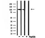 CHSY3 Polyclonal Antibody