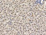 CHD6 Polyclonal Antibody