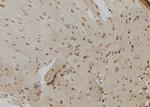 CHD8 Polyclonal Antibody