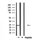 Claudin 20 Polyclonal Antibody