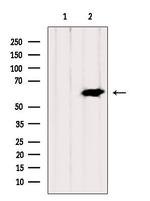 CPSF6 Polyclonal Antibody