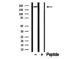 DENND4A Polyclonal Antibody