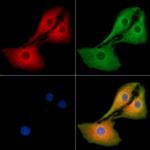 Factor XIII B Polyclonal Antibody