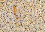 Factor XIII B Antibody in Immunohistochemistry (Paraffin) (IHC (P))