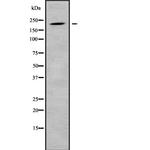 CD35 Antibody in Western Blot (WB)