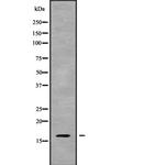 Cystatin 8 Polyclonal Antibody