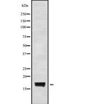 CST9LP1 Polyclonal Antibody
