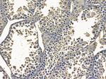Cystatin M Antibody in Immunohistochemistry (Paraffin) (IHC (P))