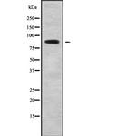 PLA2G4B Antibody in Western Blot (WB)