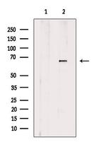 NT5C2 Polyclonal Antibody