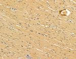 DOCK11 Polyclonal Antibody