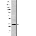 APOBEC3H Polyclonal Antibody