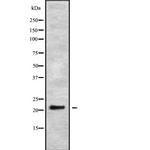 GINS2 Polyclonal Antibody