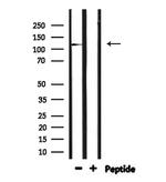 IGHMBP2 Polyclonal Antibody