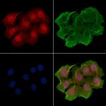 POLR1D Polyclonal Antibody