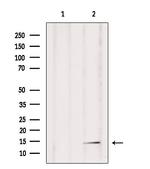 POLR2F Antibody in Western Blot (WB)