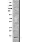 POLR2K Polyclonal Antibody