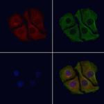 Dynactin 4 Polyclonal Antibody