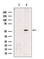Dynactin 4 Antibody in Western Blot (WB)