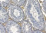 DNAL4 Antibody in Immunohistochemistry (Paraffin) (IHC (P))