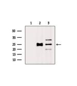 DNAL4 Antibody in Western Blot (WB)