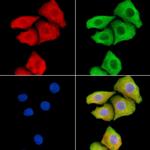 DYNLRB2 Polyclonal Antibody