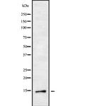 DYNLT3 Antibody in Western Blot (WB)