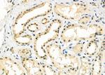 HECTD1 Polyclonal Antibody