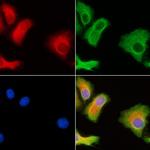 TEB4 Polyclonal Antibody