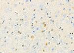 PJA Polyclonal Antibody