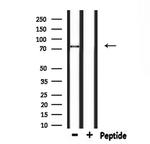 PJA Antibody in Western Blot (WB)