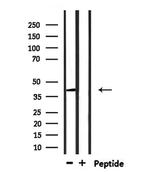 RNF167 Antibody in Western Blot (WB)