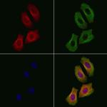 ZNRF1 Polyclonal Antibody