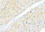 ZNRF1 Antibody in Immunohistochemistry (Paraffin) (IHC (P))
