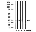 ZNRF1 Antibody in Western Blot (WB)