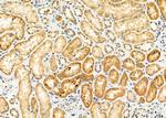 ELP3 Polyclonal Antibody