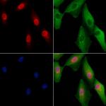 NEIL2 Polyclonal Antibody